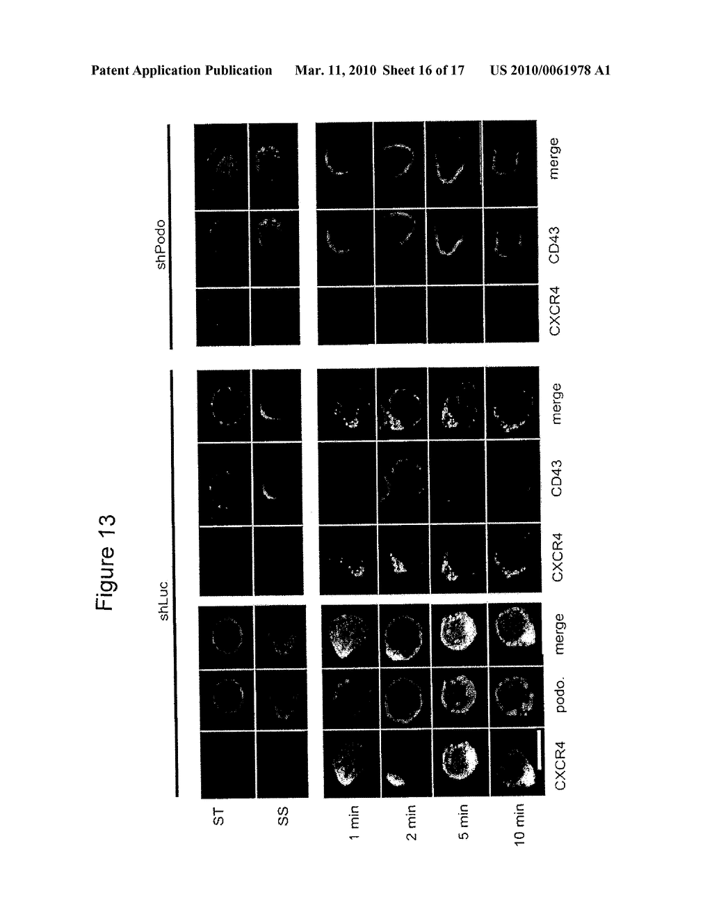 METHODS FOR DETECTING AND TREATING CANCER - diagram, schematic, and image 17