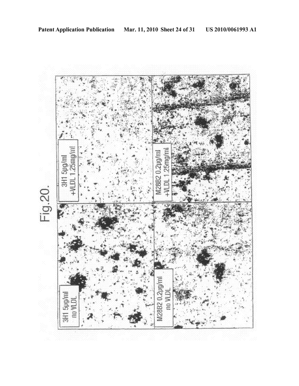 Antibodies - diagram, schematic, and image 25