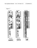 AGR2 and TFF3 Regulation in the Diagnosis and Treatment of Cancer diagram and image