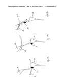  METHOD AND AN APPARATUS FOR EVISCERATION OF POULTRY diagram and image