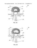 SYSTEMS AND METHODS FOR CONTROLLING AND FORMING POLYMER GELS diagram and image