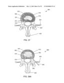 SYSTEMS AND METHODS FOR CONTROLLING AND FORMING POLYMER GELS diagram and image