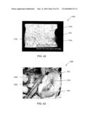 SYSTEMS AND METHODS FOR CONTROLLING AND FORMING POLYMER GELS diagram and image