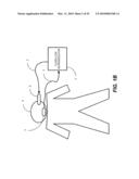 Stimulus sequencer for a closed loop neuromodulator diagram and image