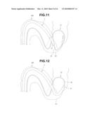 ENDOSCOPE INSERTION AID, ENDOSCOPE APPARATUS AND ENDOSCOPE APPARATUS INSERTION METHOD diagram and image