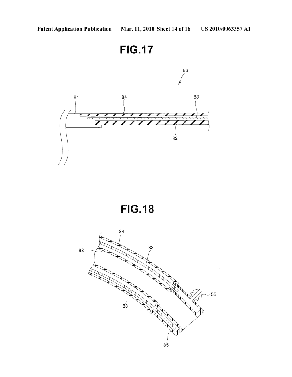 ENDOSCOPE INSERTION AID, ENDOSCOPE APPARATUS AND ENDOSCOPE APPARATUS INSERTION METHOD - diagram, schematic, and image 15