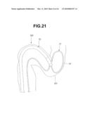 ENDOSCOPE INSERTION AID, ENDOSCOPE APPARATUS AND ENDOSCOPE APPARATUS INSERTION METHOD diagram and image