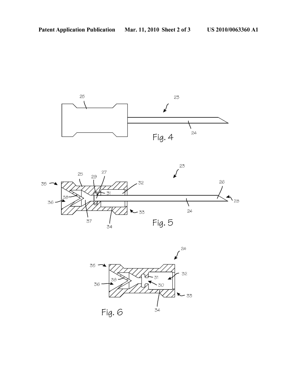 Side-arm Port Introducer - diagram, schematic, and image 03