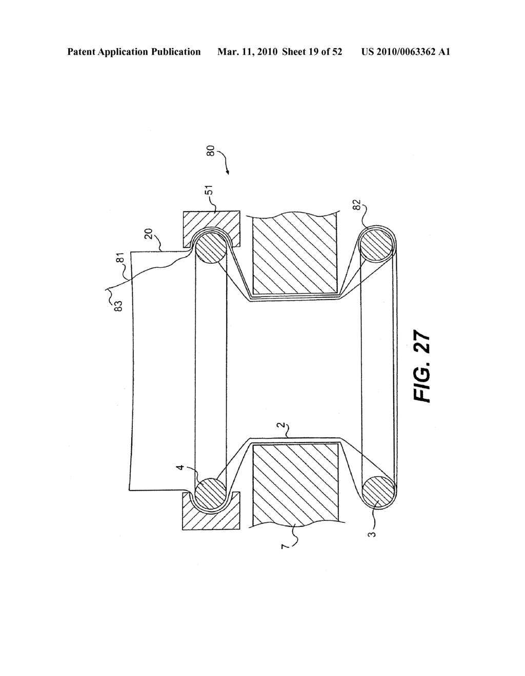 WOUND RETRACTOR DEVICE - diagram, schematic, and image 20