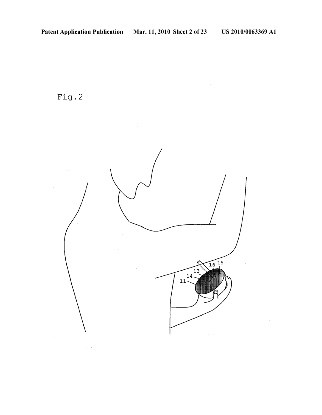 OPTICAL BIOLOGICAL INFORMATION MEASURING APPARATUS, OPTICAL BIOLOGICAL INFORMATION MEASURING METHOD, BIOLOGICAL INFORMATION DECISION APPARATUS, PROGRAM AND RECORDING MEDIUM - diagram, schematic, and image 03