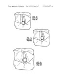 NERVE MONITORING DEVICE diagram and image