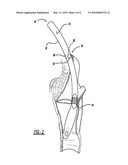 NERVE MONITORING DEVICE diagram and image