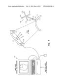 Fiducial Marker Devices, Tools, and Methods diagram and image