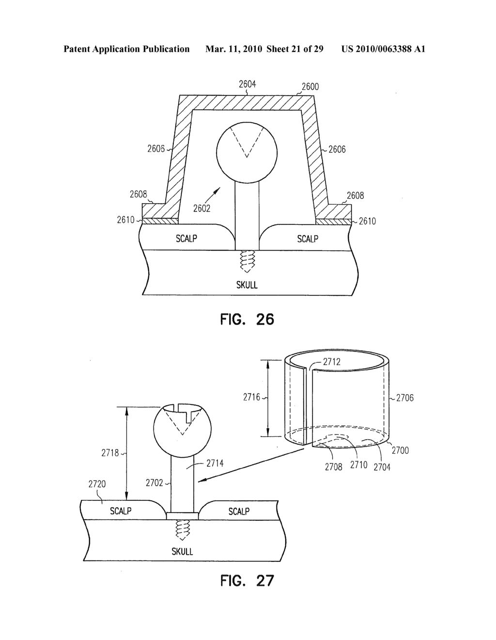 Fiducial Marker Devices, Tools, and Methods - diagram, schematic, and image 22