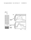 ULTRASONOGRAPH diagram and image