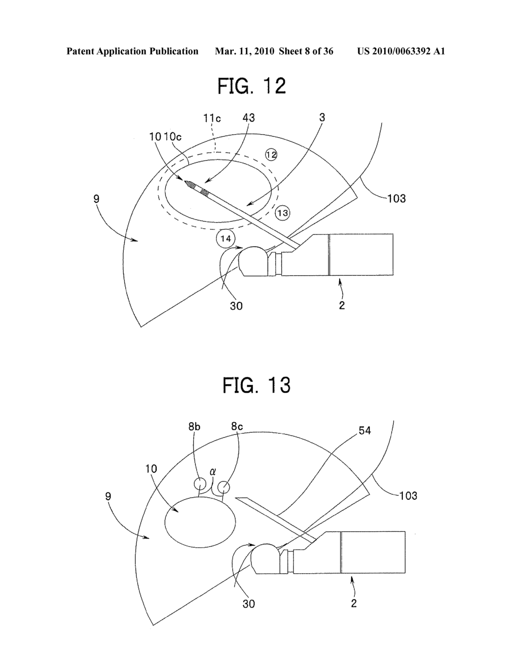 ULTRASOUND-GUIDED ABLATION METHOD AND ULTRASOUND-GUIDED ABLATION SYSTEM - diagram, schematic, and image 09