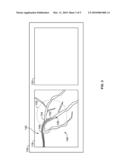 METHOD AND APPARATUS FOR CATHETER GUIDANCE USING A COMBINATION OF ULTRASOUND AND X-RAY IMAGING diagram and image