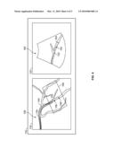 METHOD AND APPARATUS FOR CATHETER GUIDANCE USING A COMBINATION OF ULTRASOUND AND X-RAY IMAGING diagram and image