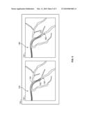 METHOD AND APPARATUS FOR CATHETER GUIDANCE USING A COMBINATION OF ULTRASOUND AND X-RAY IMAGING diagram and image