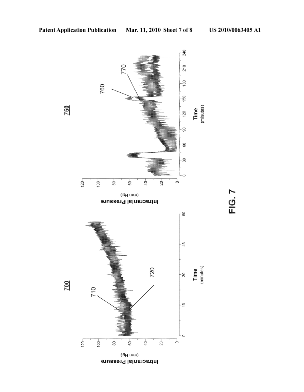 SYSTEMS, DEVICES AND METHODS FOR NONINVASIVE OR MINIMALLY-INVASIVE ESTIMATION OF INTRACRANIAL PRESSURE AND CEREBROVASCULAR AUTOREGULATION - diagram, schematic, and image 08