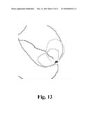 SENSOR APPARATUS AND METHOD FOR GENERATING SIGNALS INDICATIVE OF THE POSITION OR CHANGE IN POSITION OF LIMBS diagram and image