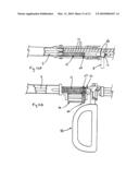 Multifunctional surgical instrument diagram and image