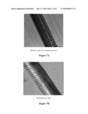 COMPOSITIONS AND METHODS FOR IMPROVED OCCLUSION OF VASCULAR DEFECTS diagram and image