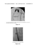 COMPOSITIONS AND METHODS FOR IMPROVED OCCLUSION OF VASCULAR DEFECTS diagram and image