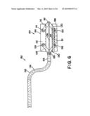 DEVICES AND METHODS FOR INTERSTITIAL INJECTION OF BIOLOGIC AGENTS INTO TISSUE diagram and image