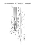 SUCTION SYSTEM diagram and image