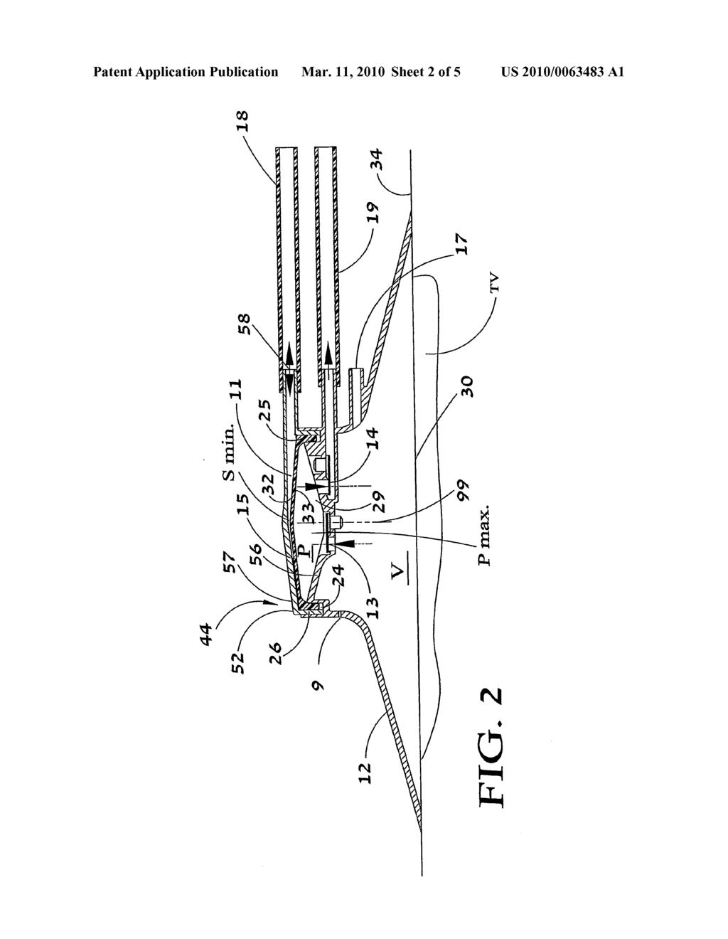 SUCTION SYSTEM - diagram, schematic, and image 03