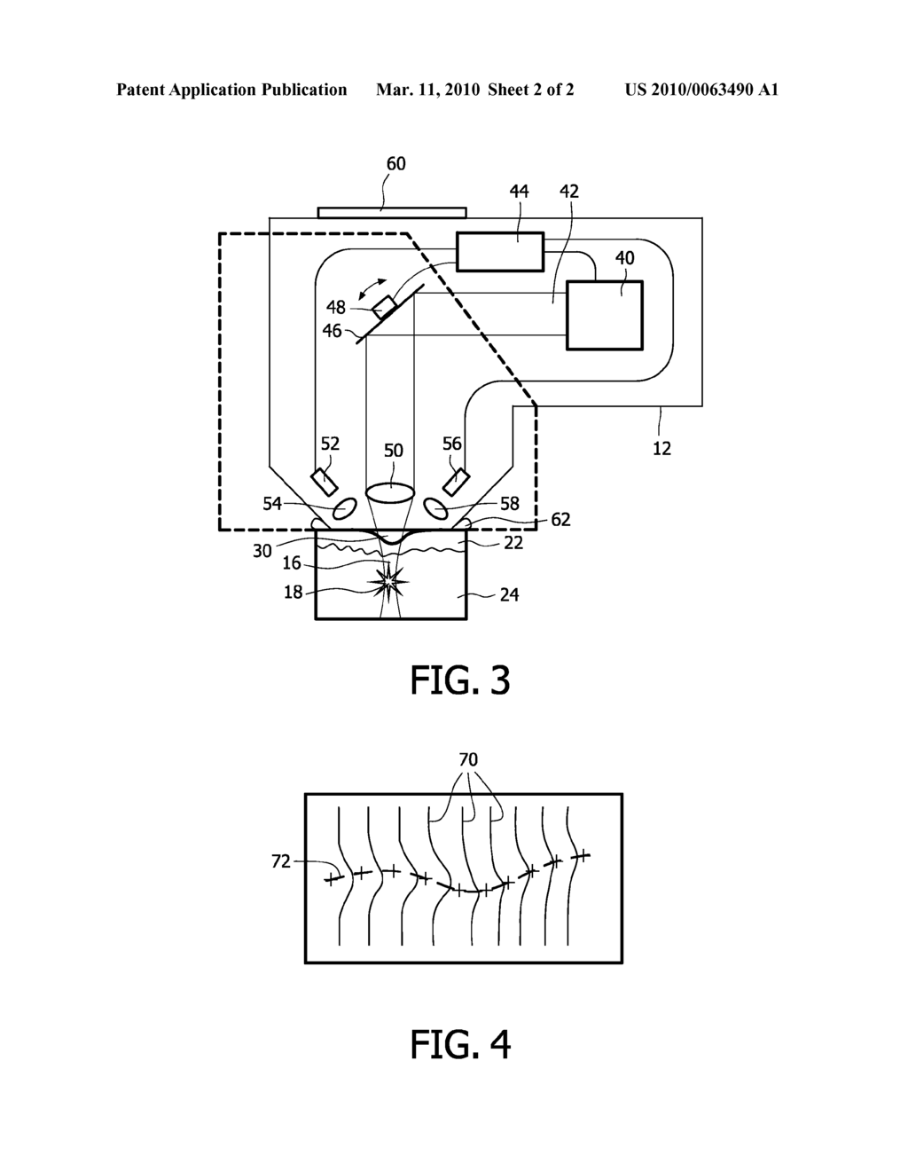 DEVICE AND METHOD FOR THE TREATMENT OF SKIN, AND USE OF THE DEVICE - diagram, schematic, and image 03