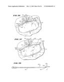 SYSTEM FOR TISSUE ABLATION diagram and image