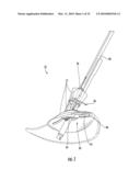 MEDICAL DEVICE FIXATION TOOL AND METHOD OF FIXATION OF A MEDICAL DEVICE diagram and image