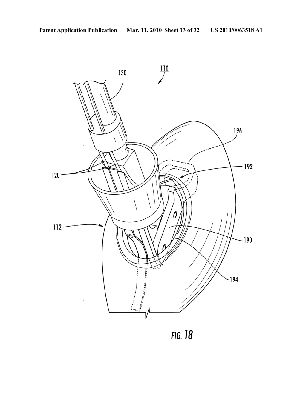 MEDICAL DEVICE FIXATION TOOL AND METHOD OF FIXATION OF A MEDICAL DEVICE - diagram, schematic, and image 14