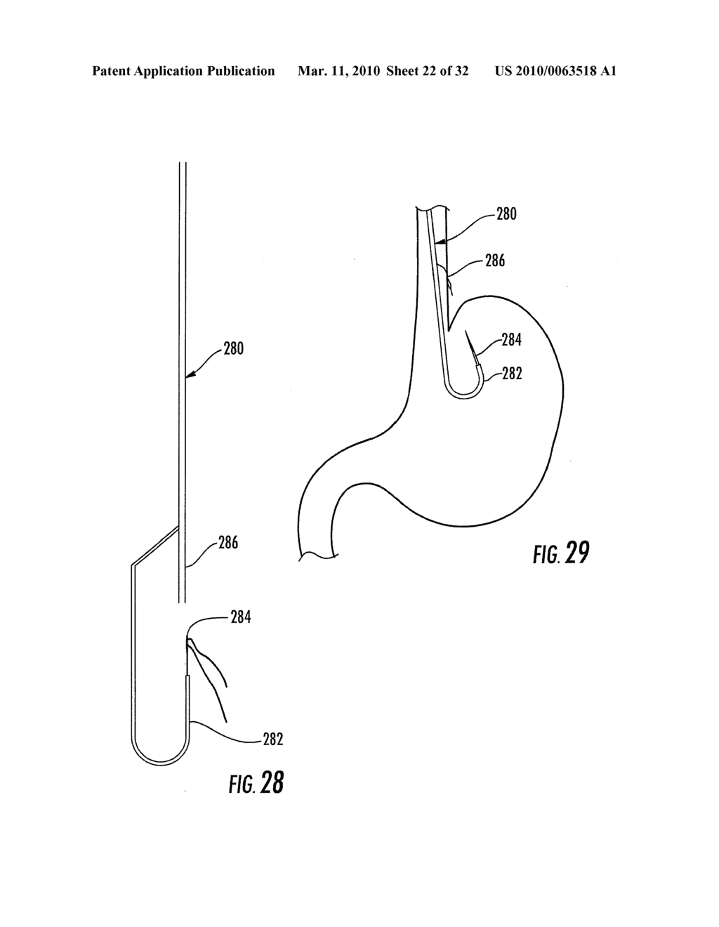 MEDICAL DEVICE FIXATION TOOL AND METHOD OF FIXATION OF A MEDICAL DEVICE - diagram, schematic, and image 23