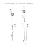 MEDICAL DEVICE FIXATION TOOL AND METHOD OF FIXATION OF A MEDICAL DEVICE diagram and image