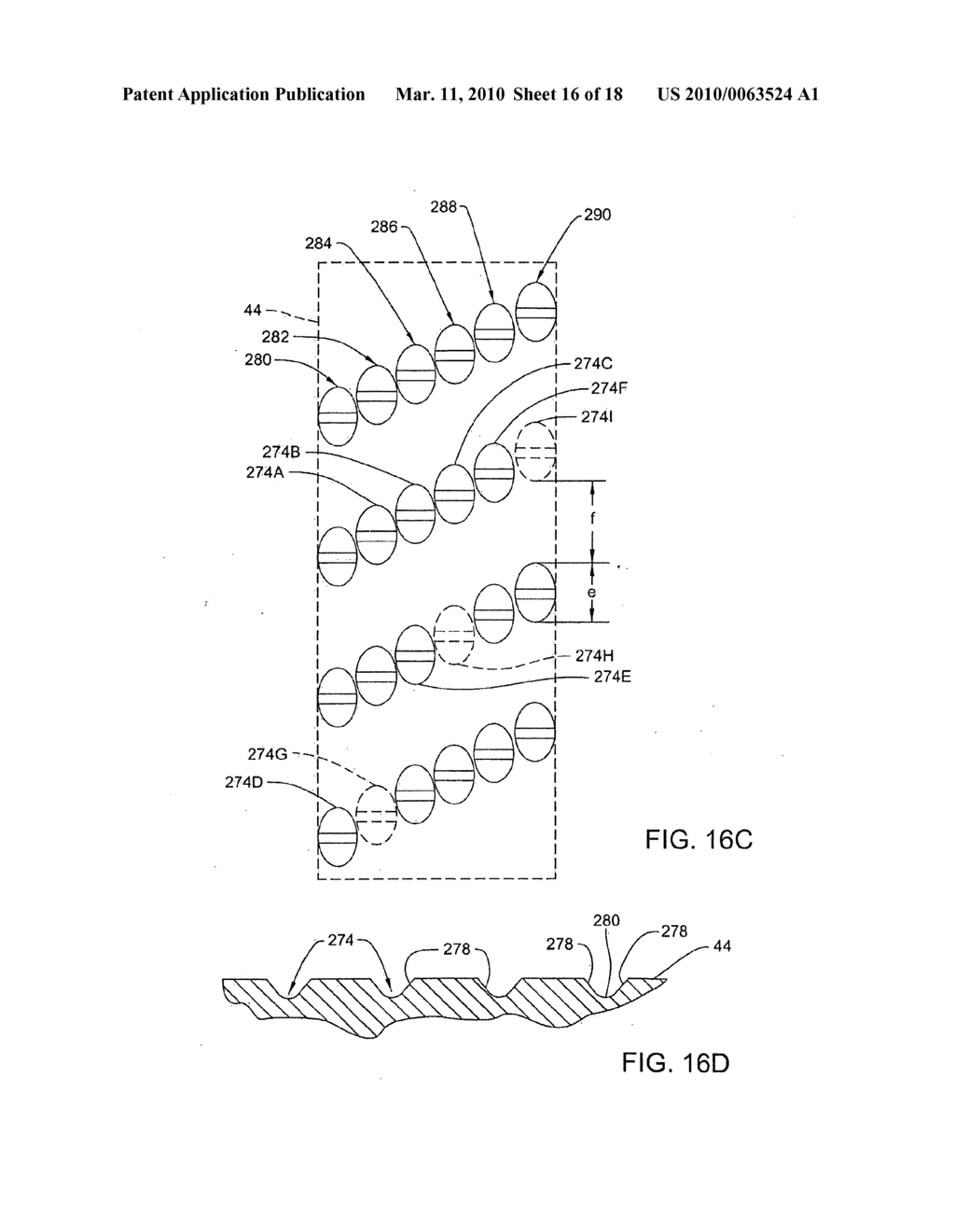 MEDICAL/SURGICAL POWERED HANDPIECE FOR ROTATING THE SHAFT OF A ACCESSORY, THE HANDPIECE HAVING A COUPLING ASSEMBLY THAT FACILITATES THE FINE OR COARSE ADJUSTMENT OF THE EXTENSION OF THE ACCESSORY SHAFT - diagram, schematic, and image 17