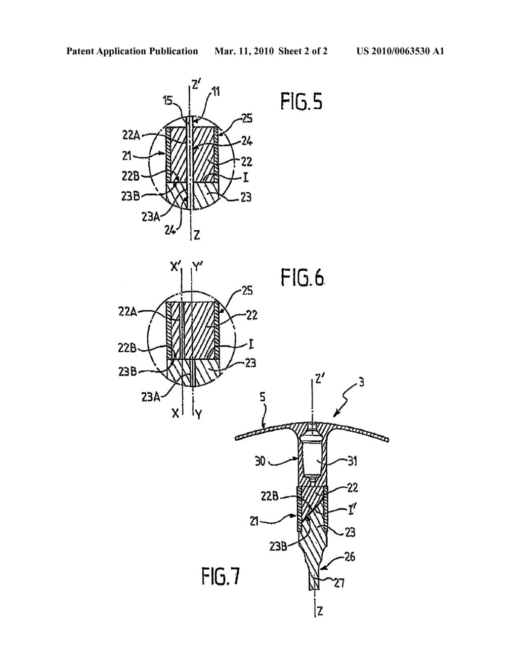 INTRA-GASTRIC BALLOON WITH DOUBLE-MEMBRANE VALVE AND CORRESPONDING KIT FOR SETTING SAME - diagram, schematic, and image 03