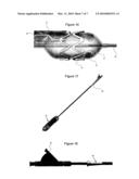 Medical Device with Non-Circumferential Surface Portion diagram and image