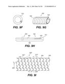 ENDOVASCULAR DEVICES AND METHODS FOR EXPLOITING INTRAMURAL SPACE diagram and image