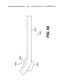 ENDOVASCULAR DEVICES AND METHODS FOR EXPLOITING INTRAMURAL SPACE diagram and image