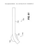 ENDOVASCULAR DEVICES AND METHODS FOR EXPLOITING INTRAMURAL SPACE diagram and image