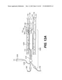 ENDOVASCULAR DEVICES AND METHODS FOR EXPLOITING INTRAMURAL SPACE diagram and image