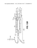 ENDOVASCULAR DEVICES AND METHODS FOR EXPLOITING INTRAMURAL SPACE diagram and image