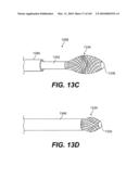 ENDOVASCULAR DEVICES AND METHODS FOR EXPLOITING INTRAMURAL SPACE diagram and image