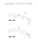 ENDOVASCULAR DEVICES AND METHODS FOR EXPLOITING INTRAMURAL SPACE diagram and image