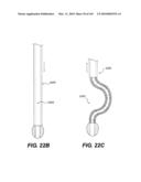 ENDOVASCULAR DEVICES AND METHODS FOR EXPLOITING INTRAMURAL SPACE diagram and image