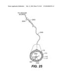 ENDOVASCULAR DEVICES AND METHODS FOR EXPLOITING INTRAMURAL SPACE diagram and image