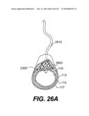 ENDOVASCULAR DEVICES AND METHODS FOR EXPLOITING INTRAMURAL SPACE diagram and image